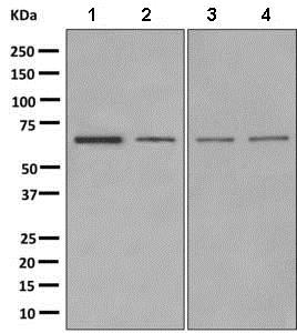 Western blot - Anti-GABA A Receptor beta 2/GABRB2 antibody [EPR10517] (AB156000)