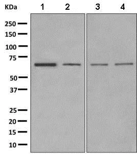 Western blot - Anti-GABA A Receptor beta 2/GABRB2 antibody [EPR10517] (AB156000)