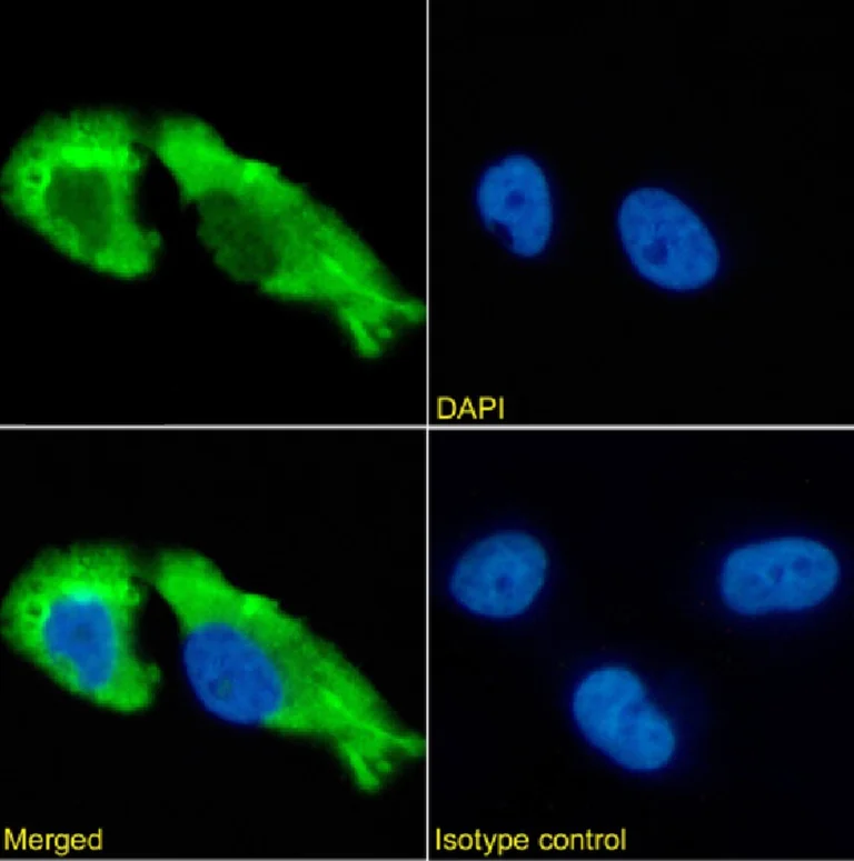 Immunocytochemistry - Anti-GABA A Receptor beta 2/GABRB2 + GABA A Receptor gamma 2/GABRG2 + GABA A Receptor alpha 1 antibody [1F4] (AB281915)