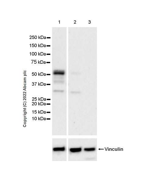 Western blot - Anti-GABA A Receptor beta 3/GABRB3 antibody [EPR25323-127] (BSA and Azide free) (AB300064), expandable thumbnail