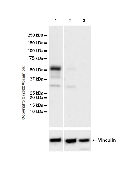 Western blot - Anti-GABA A Receptor beta 3/GABRB3 antibody [EPR25323-127] (BSA and Azide free) (AB300064)