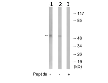 Western blot - Anti-GABA A Receptor gamma 1 antibody (AB74327)