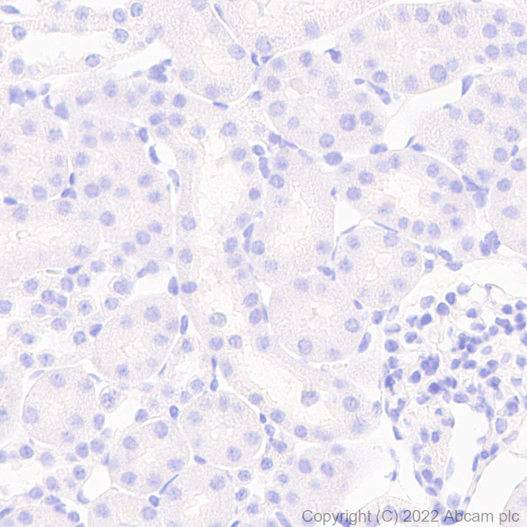 Immunohistochemistry - Anti-GABA A Receptor gamma 2/GABRG2 antibody [N452/69] - BSA and Azide free (AB307232)