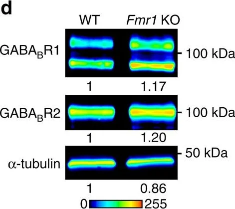 Western blot - Anti-GABA B Receptor 1 antibody [2D7] (AB55051)