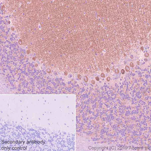 Immunohistochemistry (Formalin/PFA-fixed paraffin-embedded sections) - Anti-GABA B Receptor 1 antibody [EPR22954-47] (AB238130)