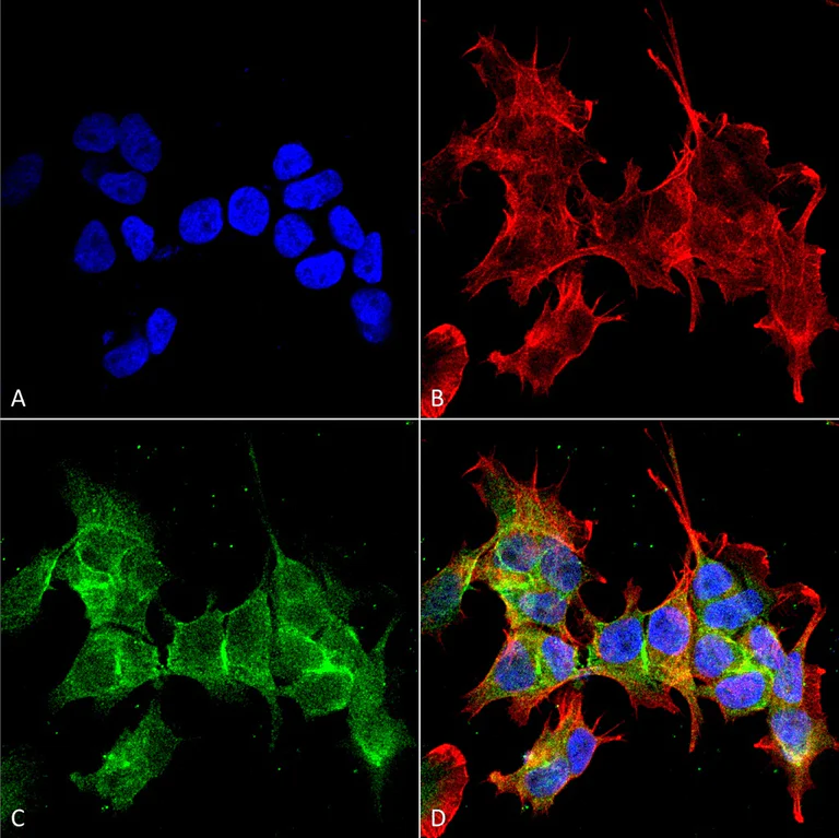 Immunocytochemistry/ Immunofluorescence - Anti-GABA B Receptor 1 antibody [N93A/49] (AB134314)