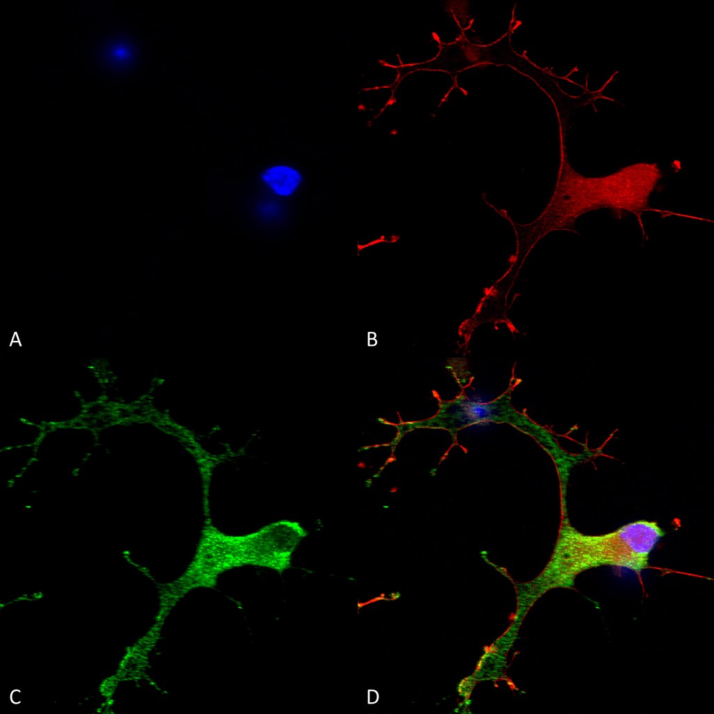 Immunocytochemistry/ Immunofluorescence - Anti-GABA B Receptor 1 antibody [N93A/49] (AB134314)