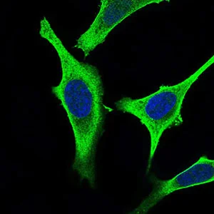 Immunocytochemistry/ Immunofluorescence - Anti-GABA B Receptor 2/GABBR2 antibody [5G7F7] (AB181736)