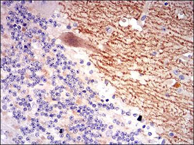 Immunohistochemistry (Formalin/PFA-fixed paraffin-embedded sections) - Anti-GABA B Receptor 2/GABBR2 antibody [5G7F7] (AB181736)