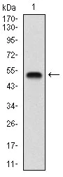 Western blot - Anti-GABA B Receptor 2/GABBR2 antibody [5G7F7] (AB181736)