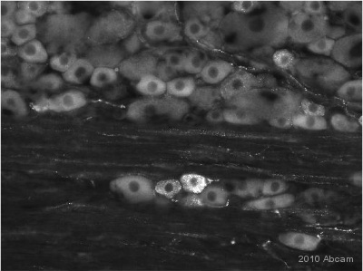 Immunohistochemistry (PFA perfusion fixed frozen sections) - Anti-GABA B Receptor 2/GABBR2 antibody (AB52248), expandable thumbnail