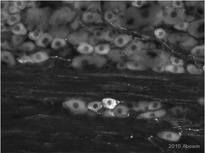 Immunohistochemistry (PFA perfusion fixed frozen sections) - Anti-GABA B Receptor 2/GABBR2 antibody (AB52248)