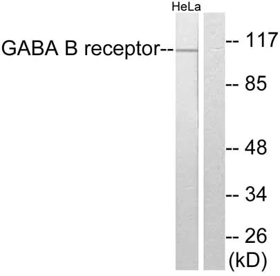 Western blot - Anti-GABA B Receptor 2/GABBR2 antibody (AB52248)