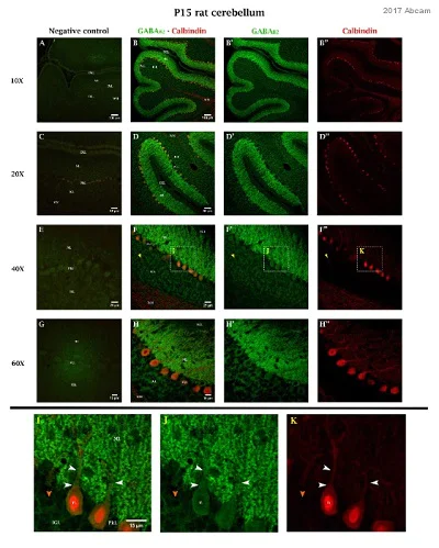 Immunohistochemistry (Formalin/PFA-fixed paraffin-embedded sections) - Anti-GABA B Receptor 2/GABBR2 antibody [EP2411Y] (AB75838)