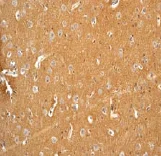 Immunohistochemistry (Formalin/PFA-fixed paraffin-embedded sections) - Anti-GABA B Receptor 2/GABBR2 antibody [EP2411Y] (AB75838)