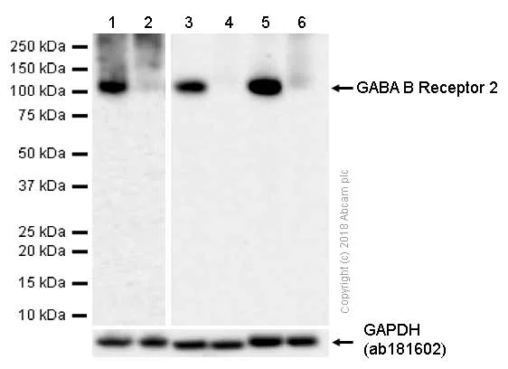 Western blot - Anti-GABA B Receptor 2/GABBR2 antibody [EP2411Y] (AB75838)