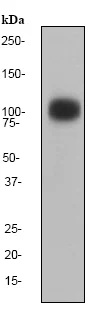 Western blot - Anti-GABA B Receptor 2/GABBR2 antibody [EP2411Y] (AB75838)