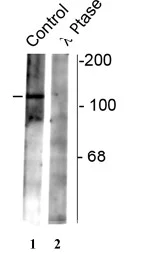 Western blot - Anti-GABA B Receptor 2/GABBR2 (phospho S783) antibody (AB72447)