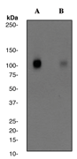 Western blot - Anti-GABA B Receptor 2/GABBR2 (phospho S884) antibody [EP2317Y] (AB68425), expandable thumbnail