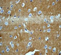 Immunohistochemistry (Formalin/PFA-fixed paraffin-embedded sections) - Anti-GABA B Receptor 2/GABBR2 (phospho S893) antibody [EP2318Y] - BSA and Azide free (AB284713)