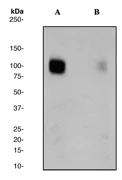 Western blot - Anti-GABA B Receptor 2/GABBR2 (phospho S893) antibody [EP2318Y] - BSA and Azide free (AB284713)