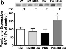 Western blot - Anti-GABA Transporter 1 / GAT 1 antibody (AB426)