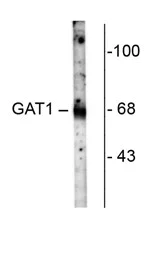 Western blot - Anti-GABA Transporter 1 / GAT 1 antibody (AB72448)