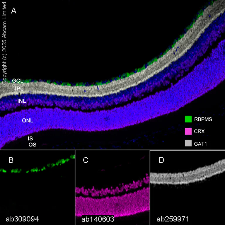 Multiplex immunohistochemistry - Anti-GABA Transporter 1 / GAT 1 antibody [EPR24202-20] (AB259971)