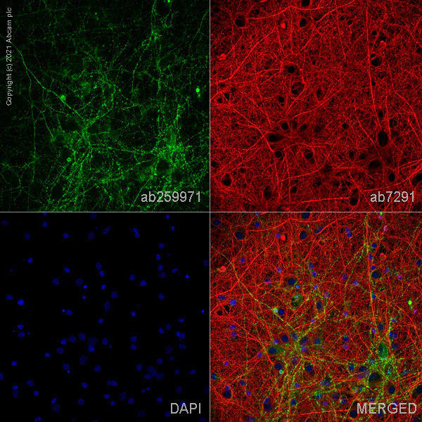 Immunocytochemistry/ Immunofluorescence - Anti-GABA Transporter 1 / GAT 1 antibody [EPR24202-20] - BSA and Azide free (AB277642)