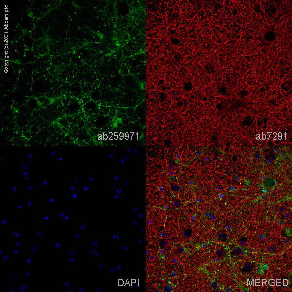 Immunocytochemistry/ Immunofluorescence - Anti-GABA Transporter 1 / GAT 1 antibody [EPR24202-20] - BSA and Azide free (AB277642)