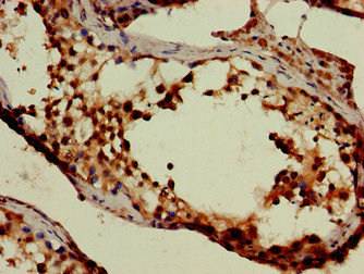 Immunohistochemistry (Formalin/PFA-fixed paraffin-embedded sections) - Anti-GABA Transporter 2 antibody (AB229815), expandable thumbnail