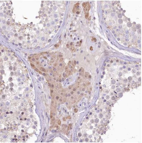 Immunohistochemistry (Formalin/PFA-fixed paraffin-embedded sections) - Anti-GABA Transporter 3 / GAT 3 antibody (AB122430)