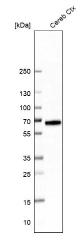 Western blot - Anti-GABA Transporter 3 / GAT 3 antibody (AB122430)
