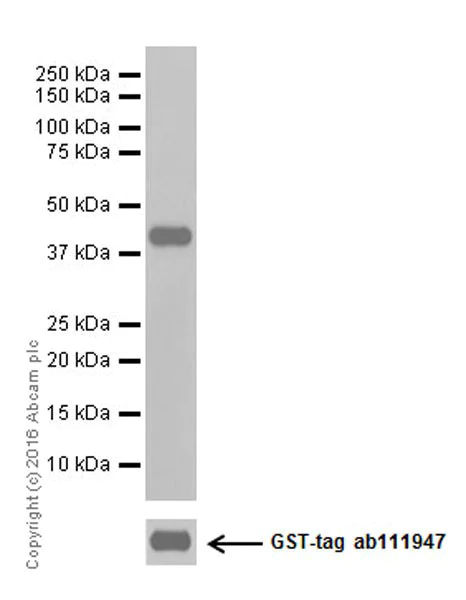 Western blot - Anti-GABARAP + GABARAPL1 + GABARAPL3 antibody [EPR18862] (AB191888)