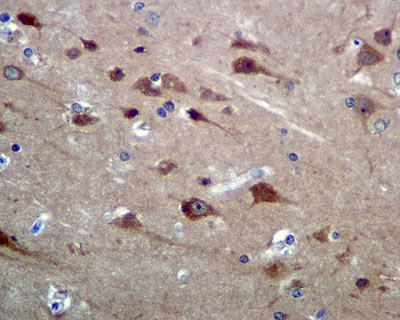 Immunohistochemistry (Formalin/PFA-fixed paraffin-embedded sections) - Anti-GABARAP+GABARAPL1+GABARAPL2 antibody [EPR4805] (ab109364), expandable thumbnail