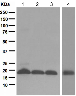 Western blot - Anti-GABARAP+GABARAPL1+GABARAPL2 antibody [EPR4805] (ab109364), expandable thumbnail