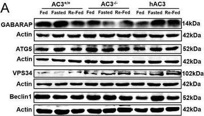 Western blot - Anti-GABARAP+GABARAPL1+GABARAPL2 antibody [EPR4805] (AB109364)