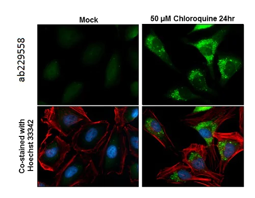 Immunocytochemistry/ Immunofluorescence - Anti-GABARAPL1 antibody - N-terminal (AB229558)