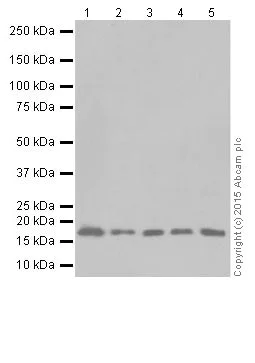 Western blot - Anti-GABARAPL1 + GABARAPL3 antibody [EPR18869] (AB191887)