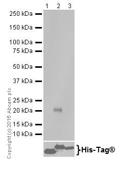 Western blot - Anti-GABARAPL1 + GABARAPL3 antibody [EPR18869] (AB191887), expandable thumbnail