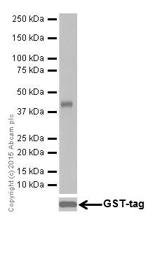 Western blot - Anti-GABARAPL1+GABARAPL3 antibody [EPR18869] - BSA and Azide free (AB251099)
