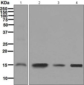 Western blot - Anti-GABARAPL2/GATE-16 antibody [EP4808] (AB126607)