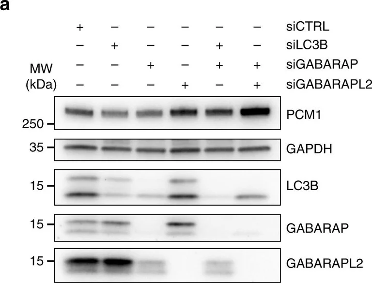 Western blot - Anti-GABARAPL2/GATE-16 antibody [EP4808] (AB126607)