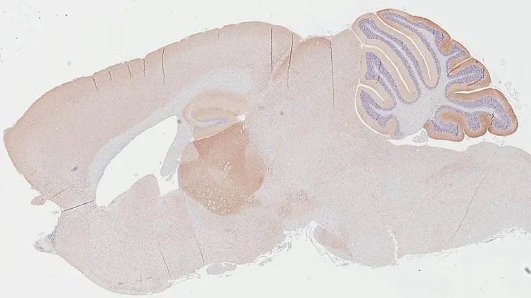 Immunohistochemistry (Formalin/PFA-fixed paraffin-embedded sections) - Anti-GABBR1 antibody [GT83] - BSA and Azide free (AB325858)