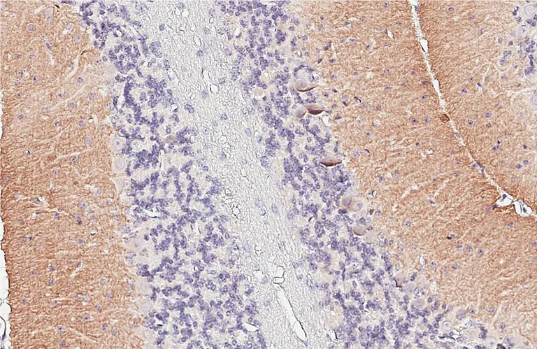 Immunohistochemistry (Formalin/PFA-fixed paraffin-embedded sections) - Anti-GABBR1 antibody [GT83] - BSA and Azide free (AB325858)