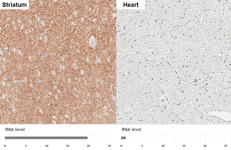 Immunohistochemistry (Formalin/PFA-fixed paraffin-embedded sections) - Anti-GABBR1 antibody [GT83] - BSA and Azide free (AB325858)
