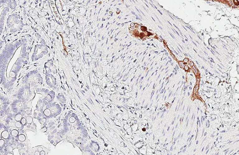 Immunohistochemistry (Formalin/PFA-fixed paraffin-embedded sections) - Anti-GABBR1 antibody [GT83] - BSA and Azide free (AB325858)