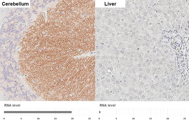 Immunohistochemistry (Formalin/PFA-fixed paraffin-embedded sections) - Anti-GABBR1 antibody [GT83] - BSA and Azide free (AB325858)