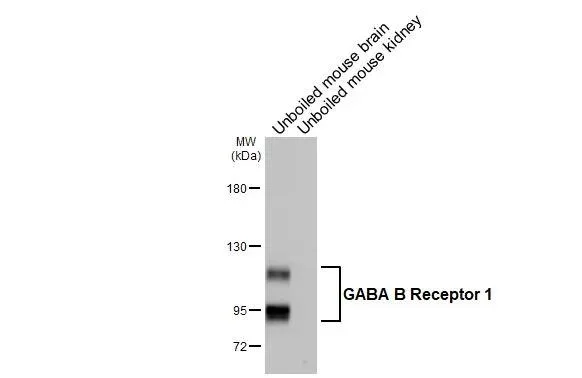 Western blot - Anti-GABBR1 antibody [GT83] - BSA and Azide free (AB325858)