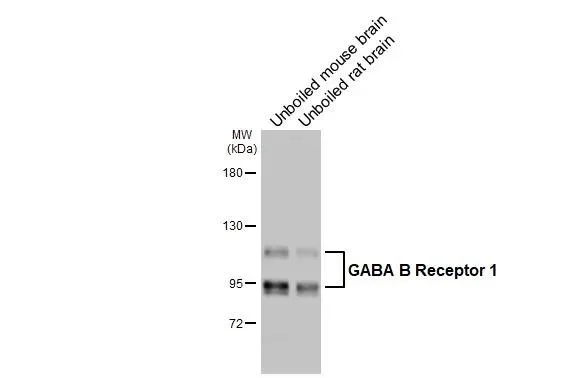Western blot - Anti-GABBR1 antibody [GT83] - BSA and Azide free (AB325858)